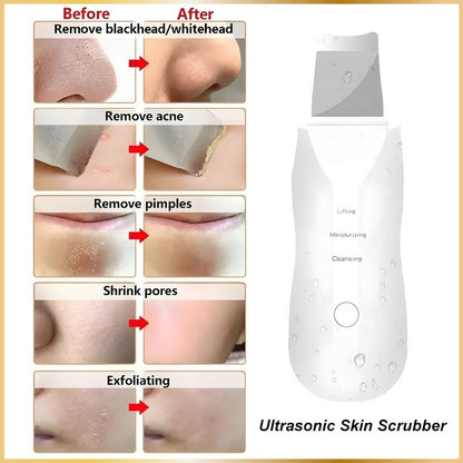 Épurateur Visage Ultrasonique 4-en-1 Lift & Clean
