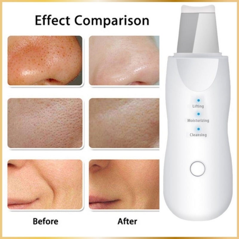 Épurateur Visage Ultrasonique 4-en-1 Lift & Clean
