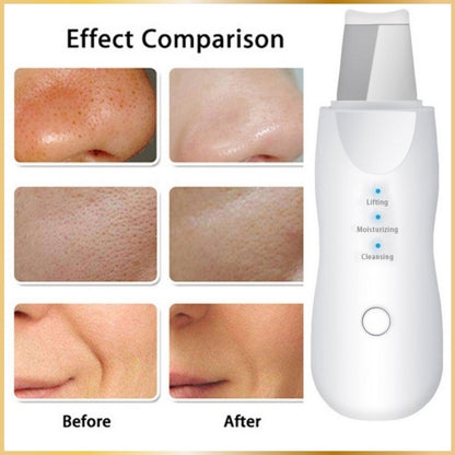 Épurateur Visage Ultrasonique 4-en-1 Lift & Clean