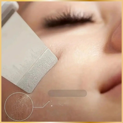 Épurateur Visage Ultrasonique 4-en-1 Lift & Clean