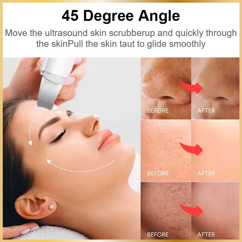 Épurateur Visage Ultrasonique 4-en-1 Lift & Clean